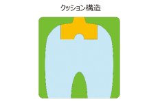画像4: VARILITE ソロ PSV (4)